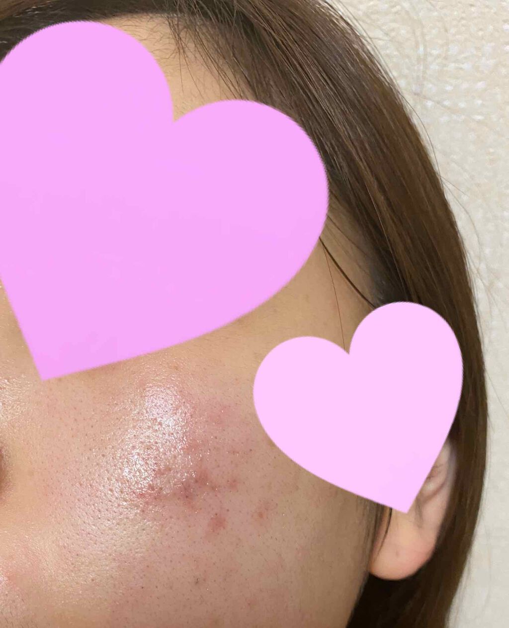 バランスケア ローション W II/d プログラム/化粧水を使ったクチコミ(2枚目)