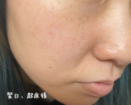 サミュ PHセンシティブクリーム/SAM'U/フェイスクリームを使ったクチコミ(5枚目)