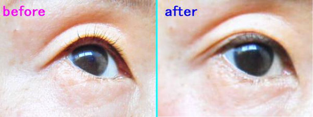 マイクロファイバー /ビー・エヌ/二重まぶた用アイテムを使ったクチコミ(3枚目)