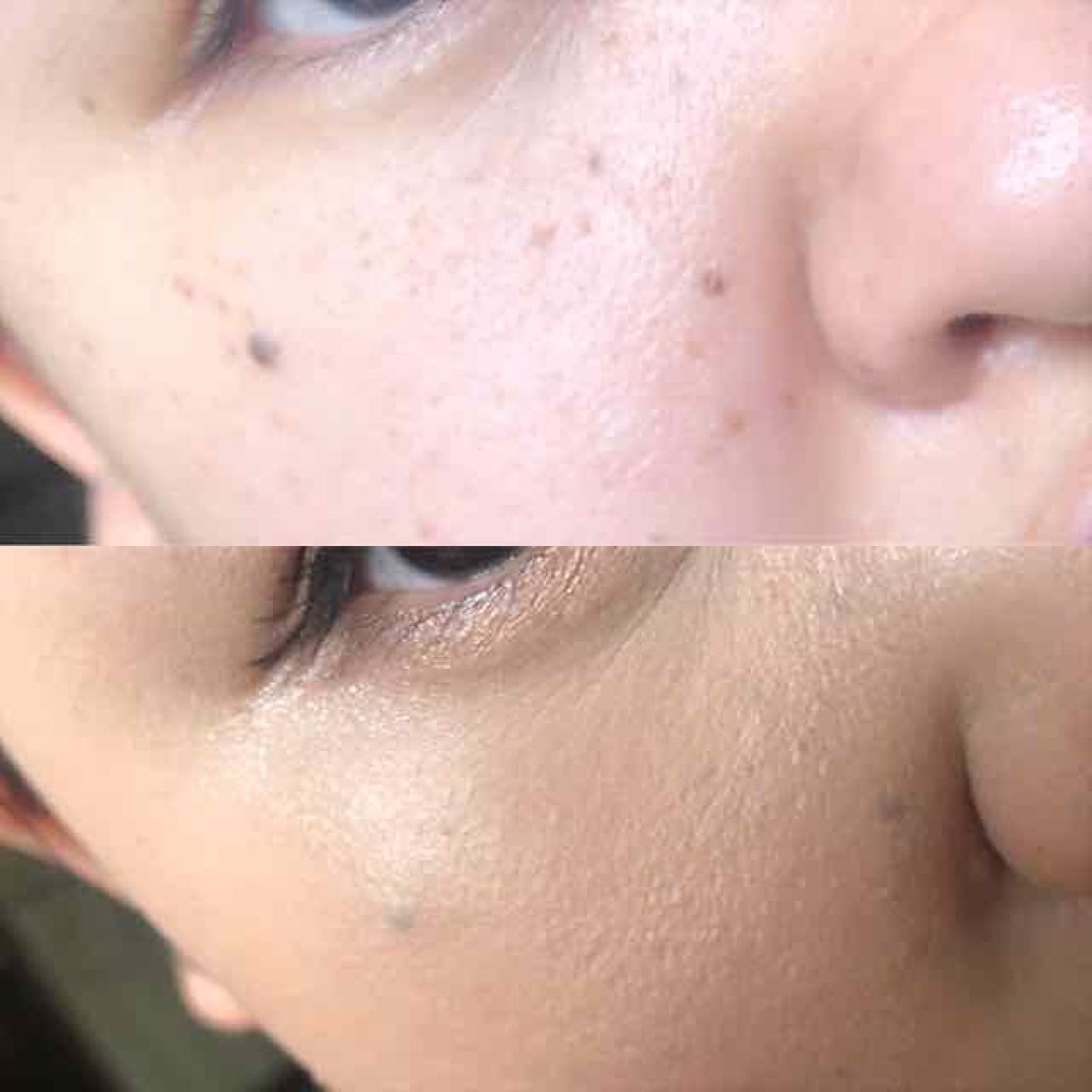 ホワイトニングパクトAII/media/パウダーファンデーションを使ったクチコミ(1枚目)