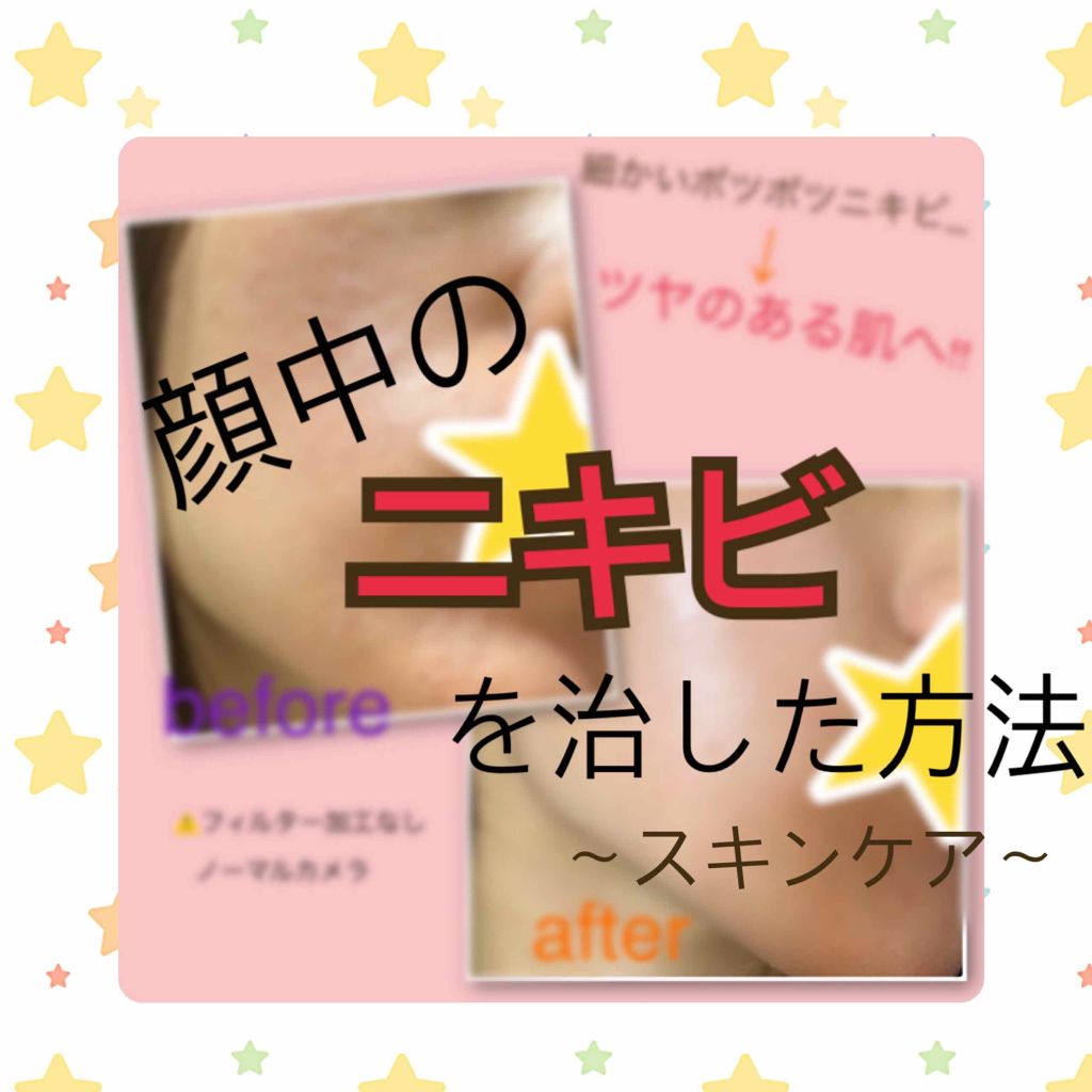 ハトムギ保湿ジェル(ナチュリエ スキンコンディショニングジェル)/ナチュリエ/美容液を使ったクチコミ（1枚目）