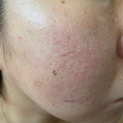 カラーグローファンデーション/sirocos/クリーム・エマルジョンファンデーションを使ったクチコミ(6枚目)