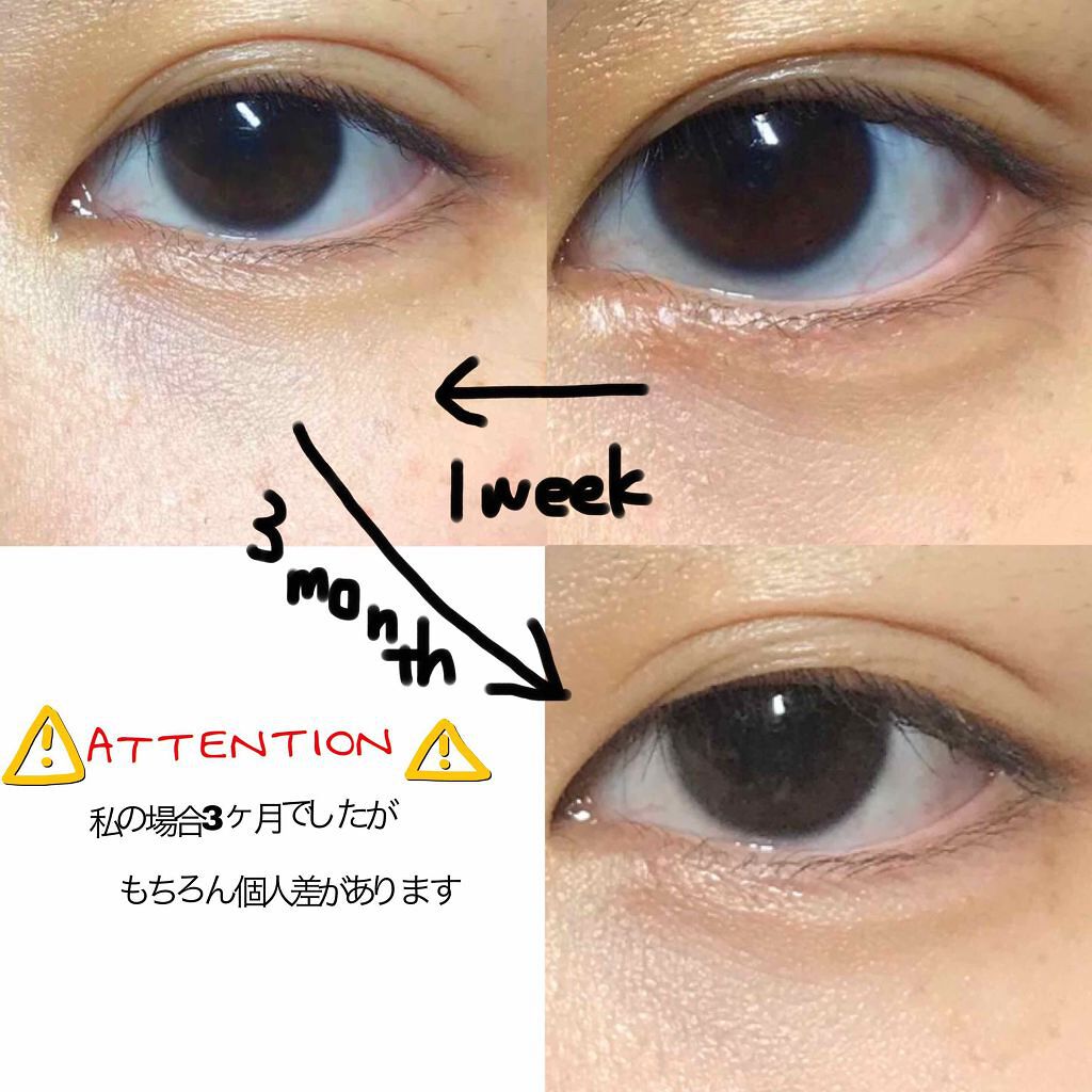 のびーるアイテープ(絆創膏タイプ、レギュラー)/DAISO/二重まぶた用アイテムを使ったクチコミ(2枚目)