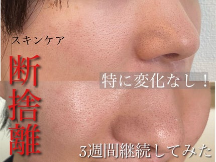 エクサージュホワイト ホワイトライズ ミルク/ALBION/乳液を使ったクチコミ(1枚目)