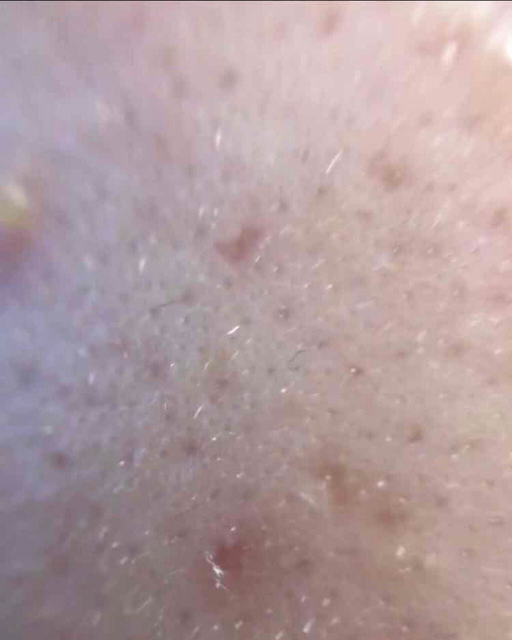 薬用保湿化粧水/オードムーゲ/化粧水を使ったクチコミ(9枚目)