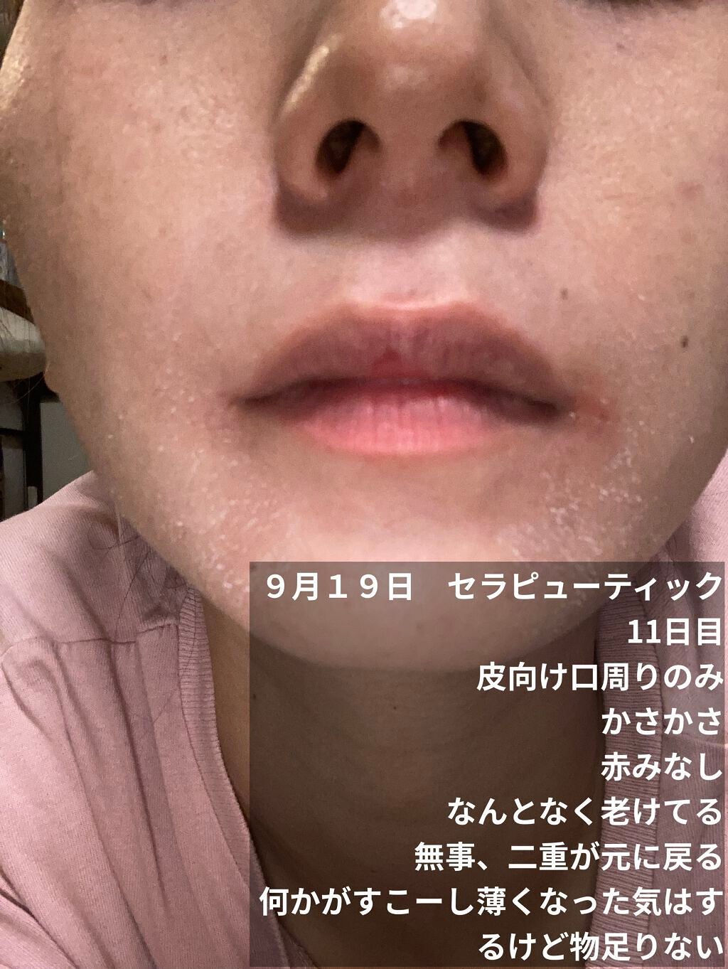 ミラミックス/ZO Skin Health/フェイスクリームを使ったクチコミ(2枚目)