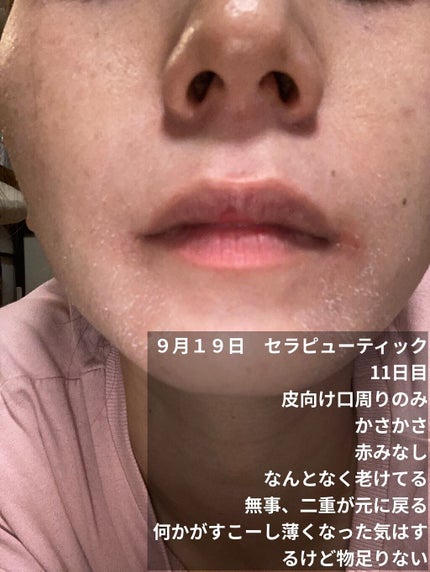 ミラミン/ZO Skin Health/フェイスクリームを使ったクチコミ(2枚目)