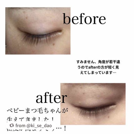 スカルプD ボーテ ピュアフリーアイラッシュセラム プレミアム/アンファー(スカルプD)/まつげ美容液を使ったクチコミ(2枚目)