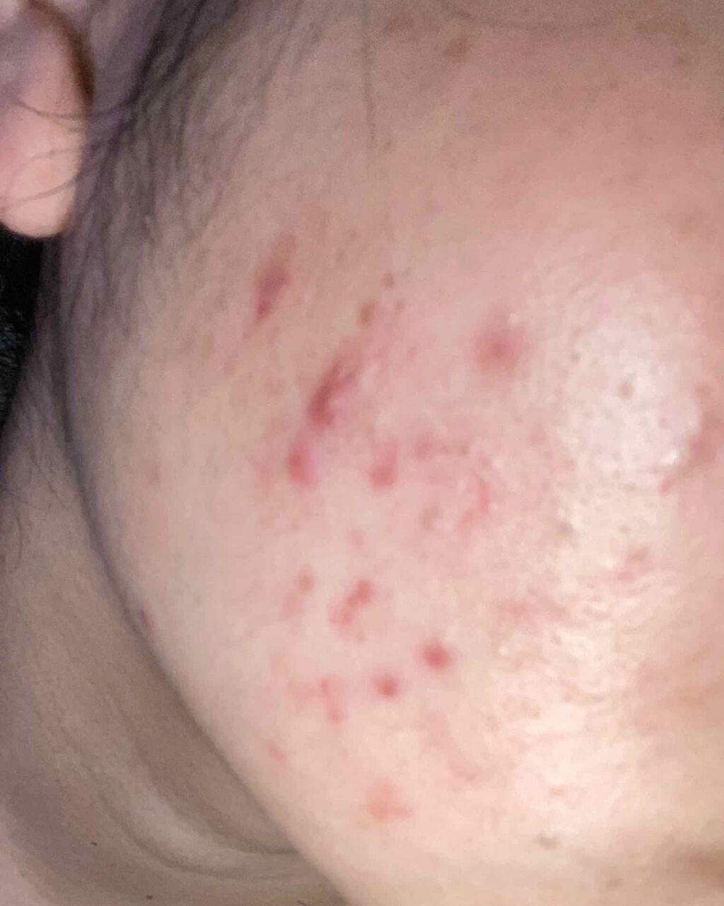 明色美顔水 薬用化粧水/美顔/化粧水を使ったクチコミ（2枚目）