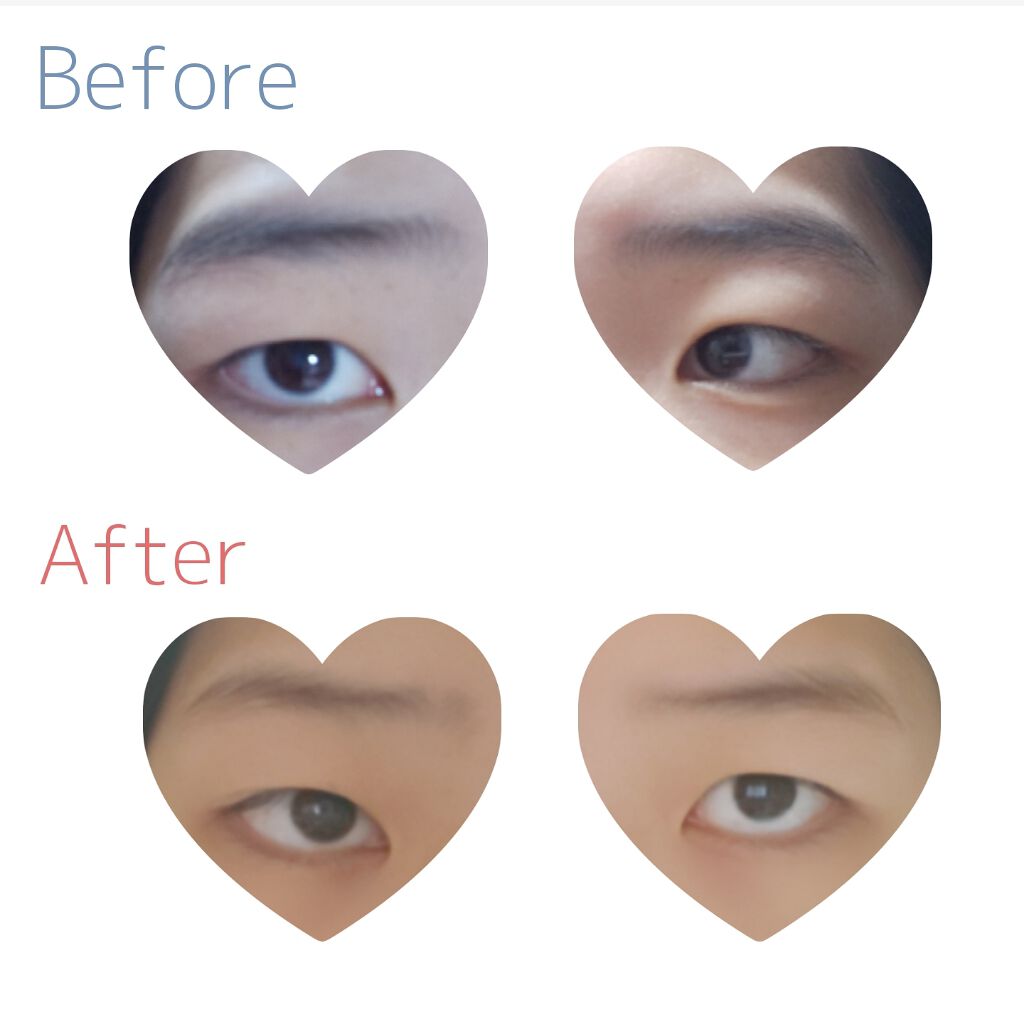 脱色クリーム スピーディー/エピラット/ムダ毛ケアを使ったクチコミ（2枚目）