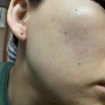 DHC ビタミンBミックス/DHC/美容サプリメントを使ったクチコミ(1枚目)