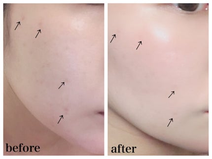 ピンクティーツリーカバークッション/APLIN/クッションファンデーションを使ったクチコミ(3枚目)