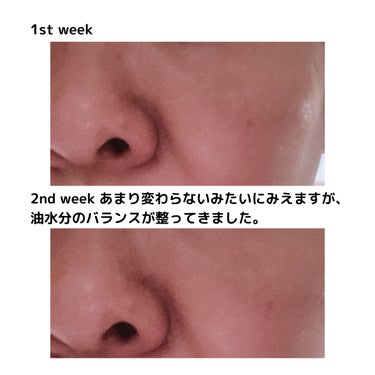 yuki_love_kcosme on LIPS 「#gifted【Jumiso】SnailMucin95Pept..」（3枚目）