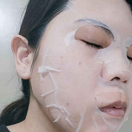 レッドブレミッシュクイックPHAシートマスク/Dr.G/シートマスク・パックを使ったクチコミ(4枚目)