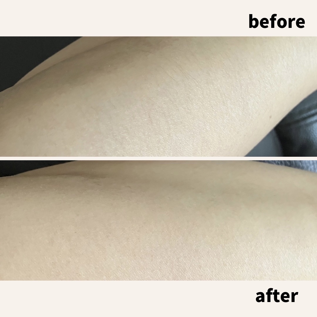 Memeのクチコミ「進化してるね〜！昔の除毛クリームは匂いがきつかった記憶。今のは良い香りがしますね。20年ぶりく.....」（3枚目）