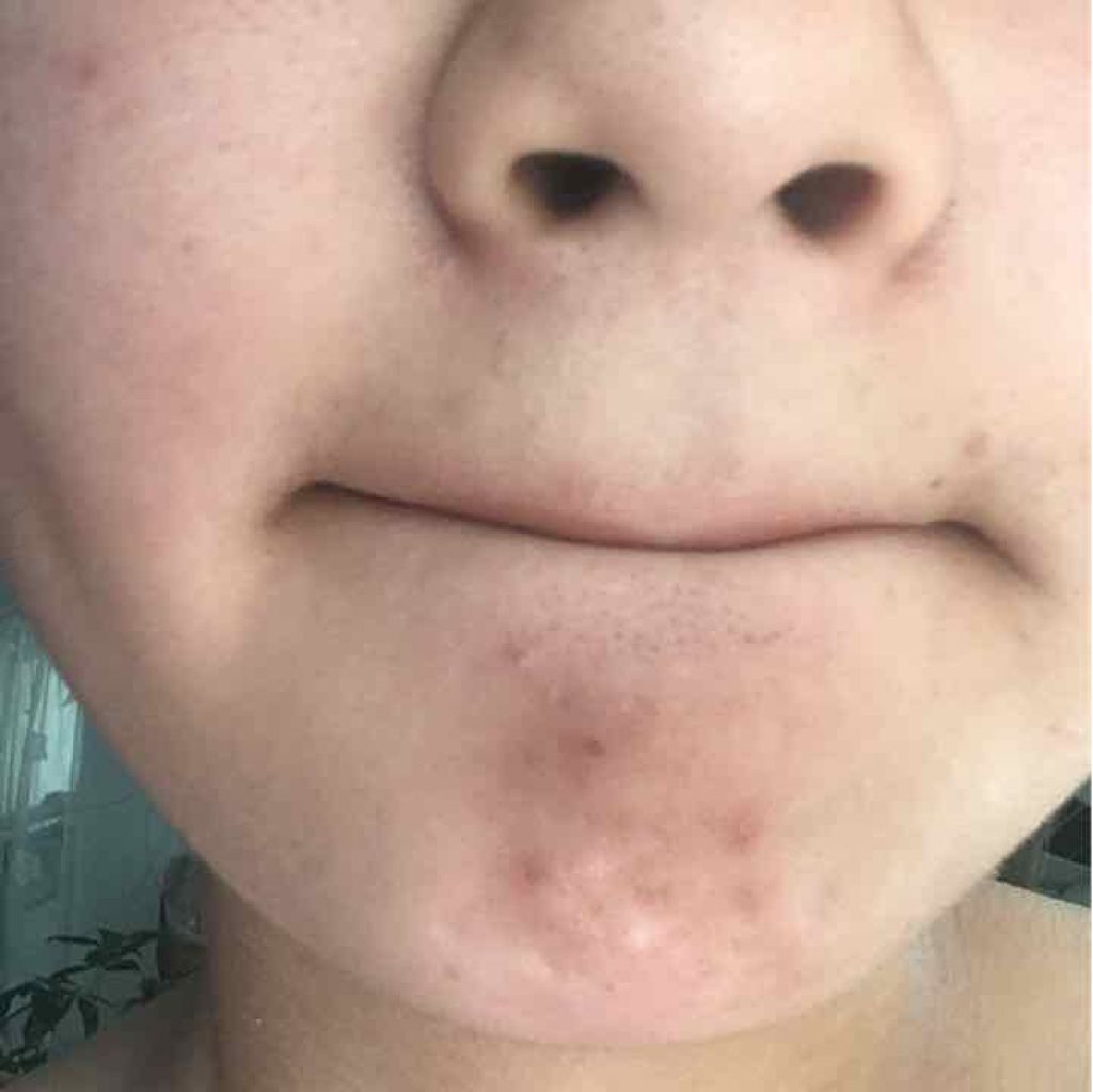 ハトムギ化粧水(ナチュリエ スキンコンディショナー R )/ナチュリエ/化粧水を使ったクチコミ(2枚目)