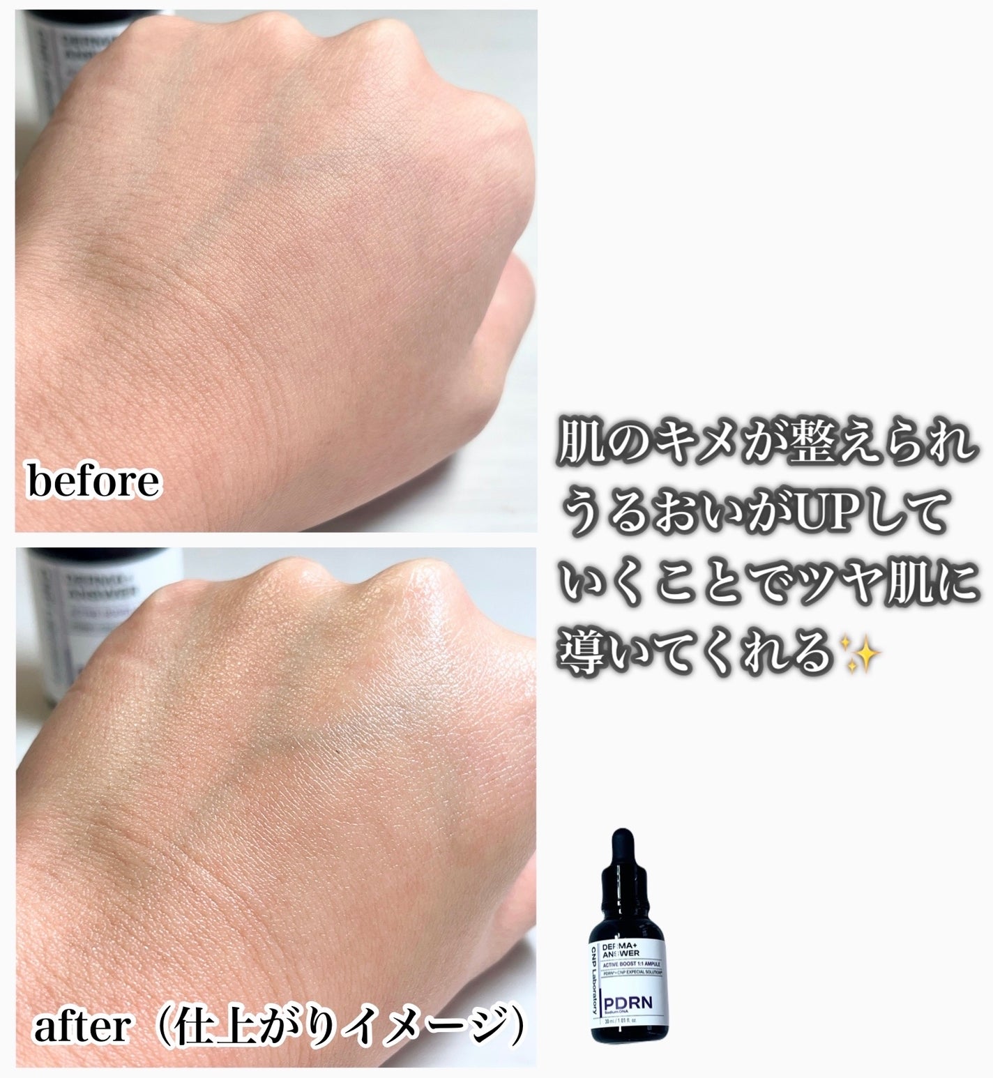ダーマアンサー PDRN アクティブブースト1:1アンプル/CNP Laboratory/美容液を使ったクチコミ(4枚目)