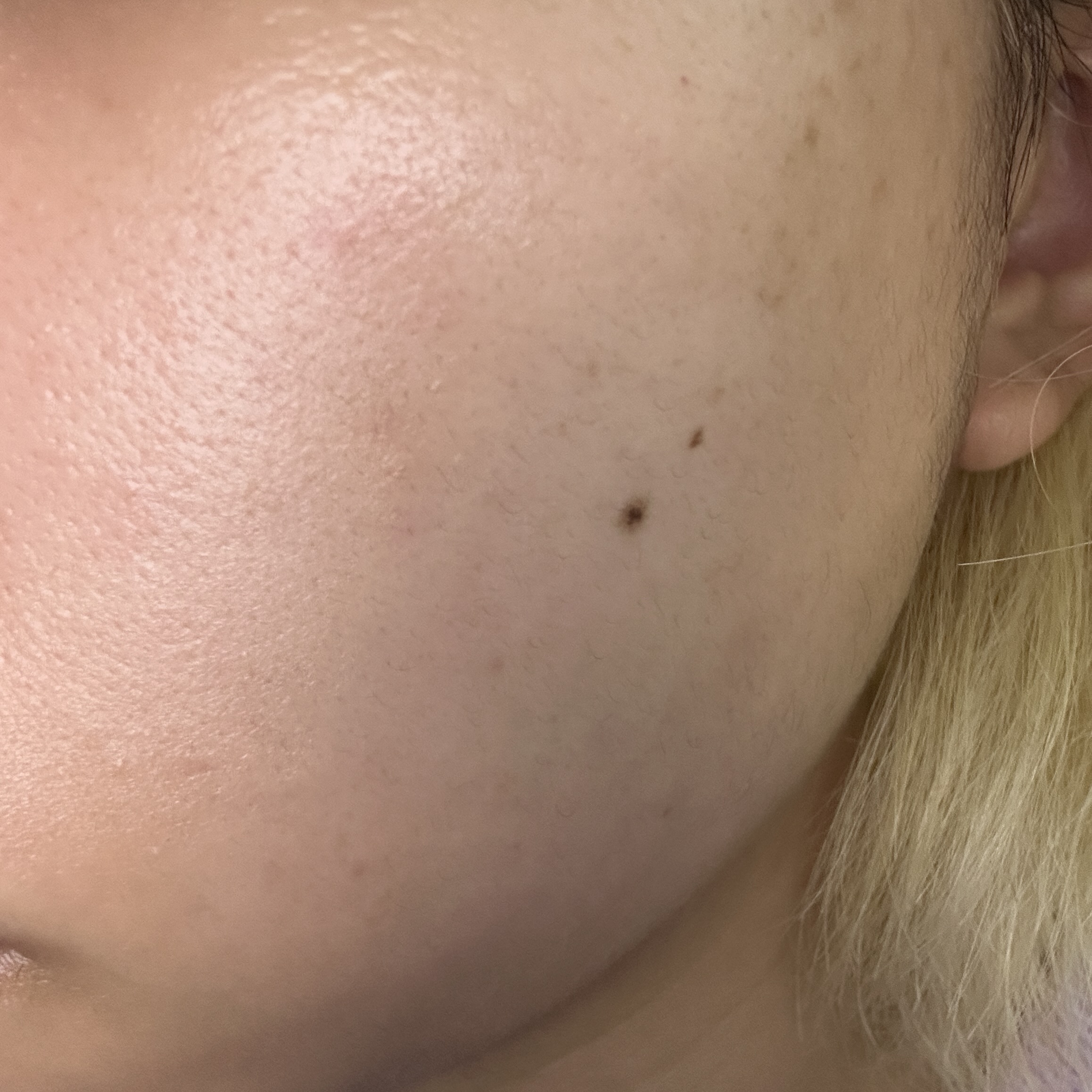 アイレノールすっぴんクリーム 3.0/IRENOL/クリームコンシーラーを使ったクチコミ（2枚目）