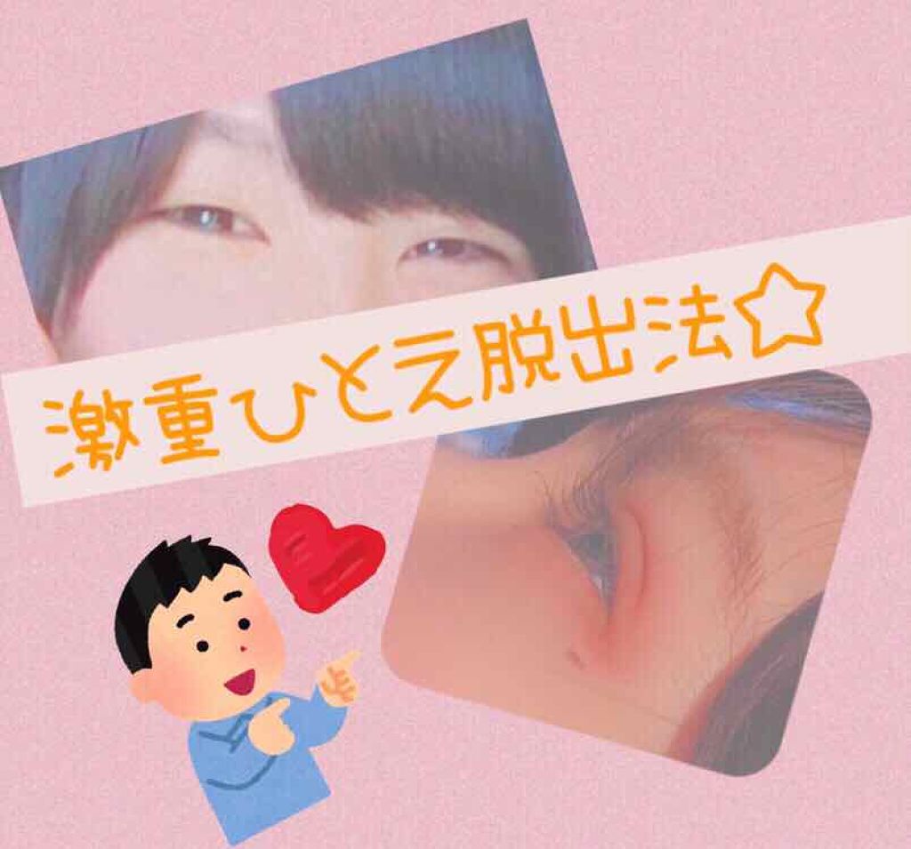 アクティブアイトークII/アイトーク/二重まぶた用アイテムを使ったクチコミ（1枚目）