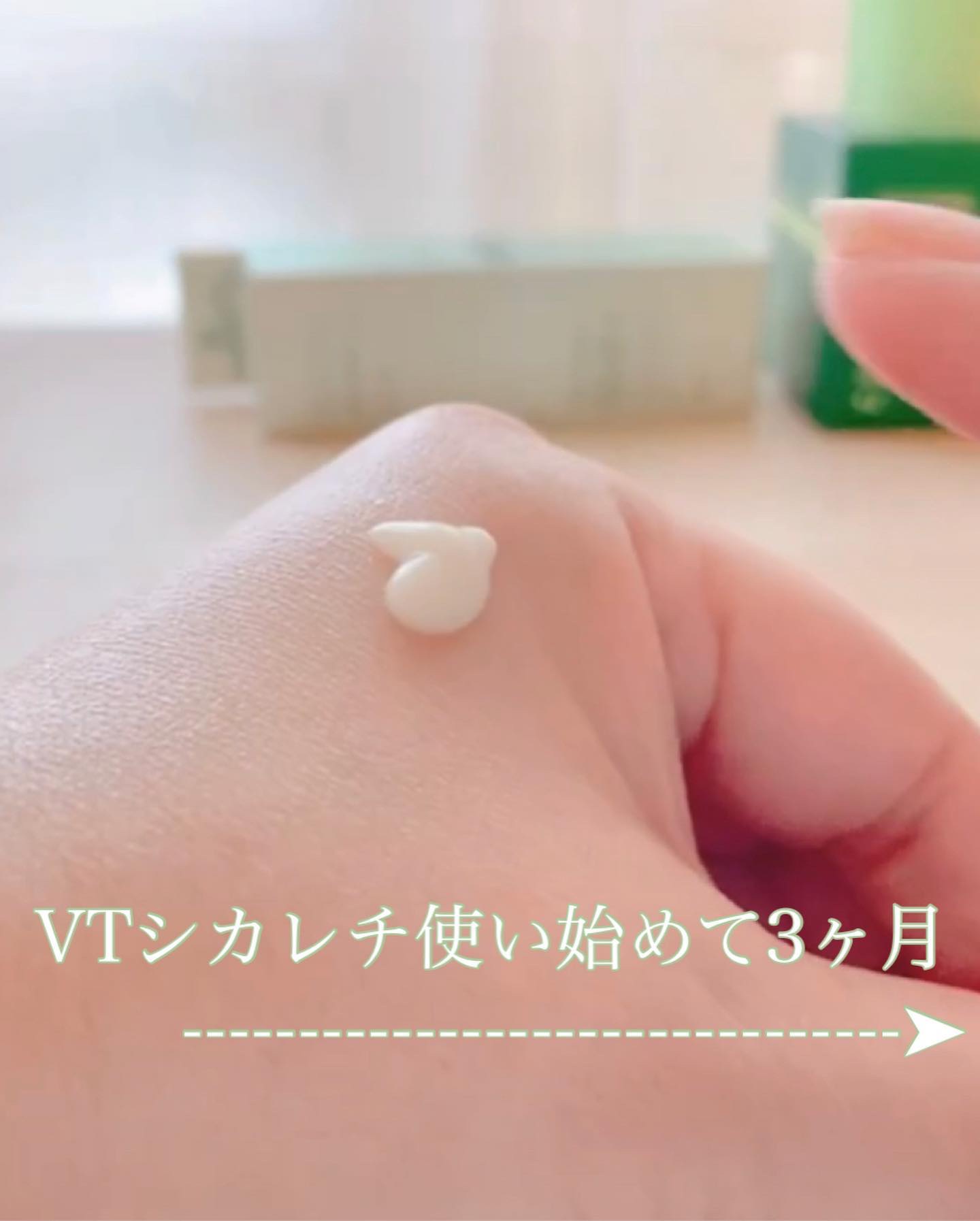 シカレチA エッセンス0.1/VT/美容液を使ったクチコミ（1枚目）