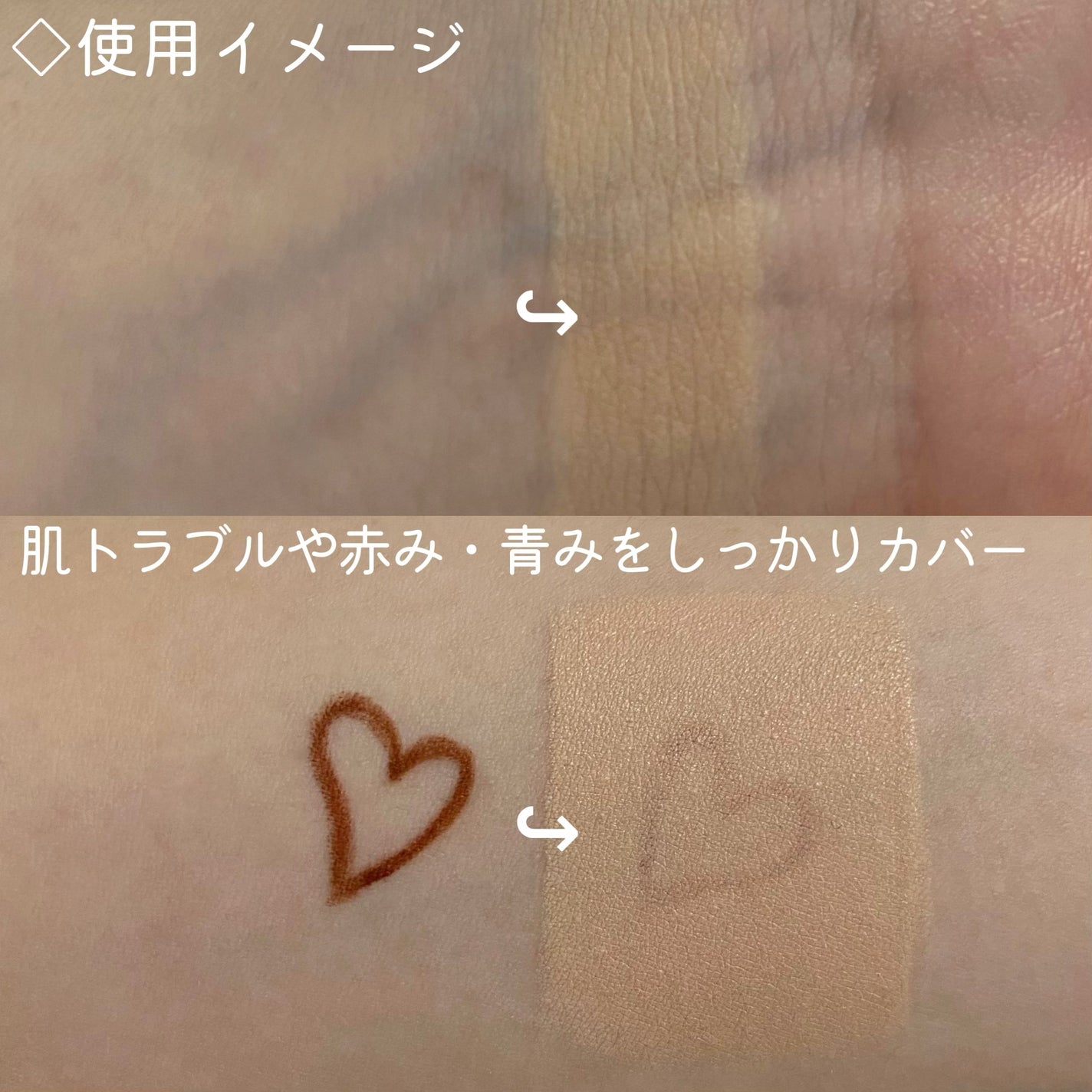 ダーマシンコンシーラー/23years old/リキッドコンシーラーを使ったクチコミ(4枚目)