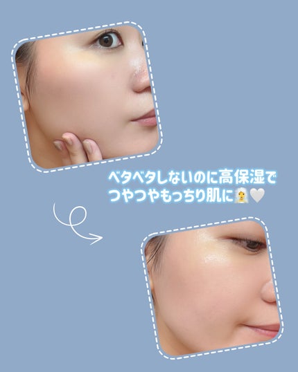 プロバイオシカ インテンシブ アンプル/SKIN1004/美容液を使ったクチコミ(4枚目)