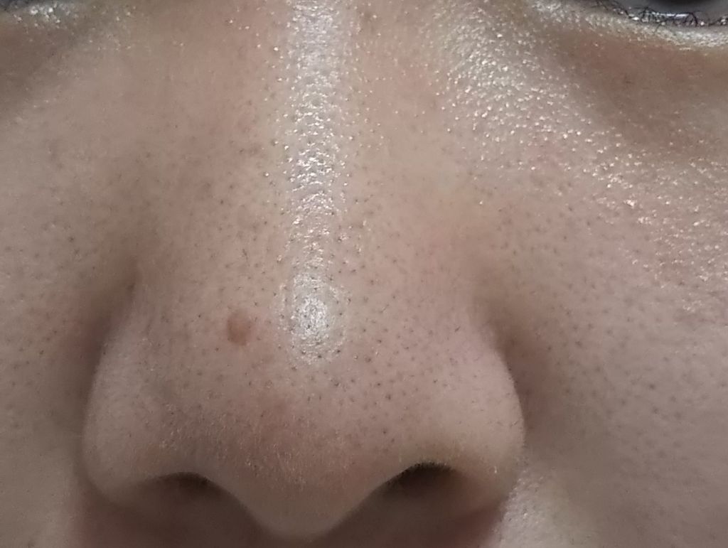 精製水(医薬品)/日本薬局方/その他を使ったクチコミ（2枚目）