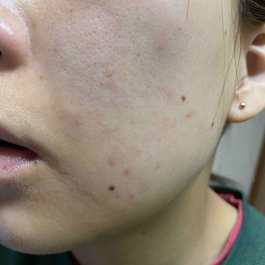 エリクシール ルフレ バランシング みずクリーム/エリクシール/フェイスクリームを使ったクチコミ(2枚目)