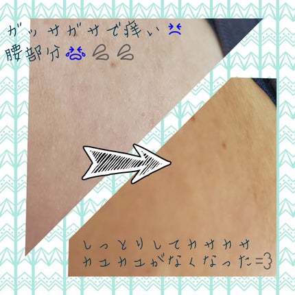 ベターパンテノールリペアボディクリーム/SOME BY MI/ボディクリームを使ったクチコミ(4枚目)