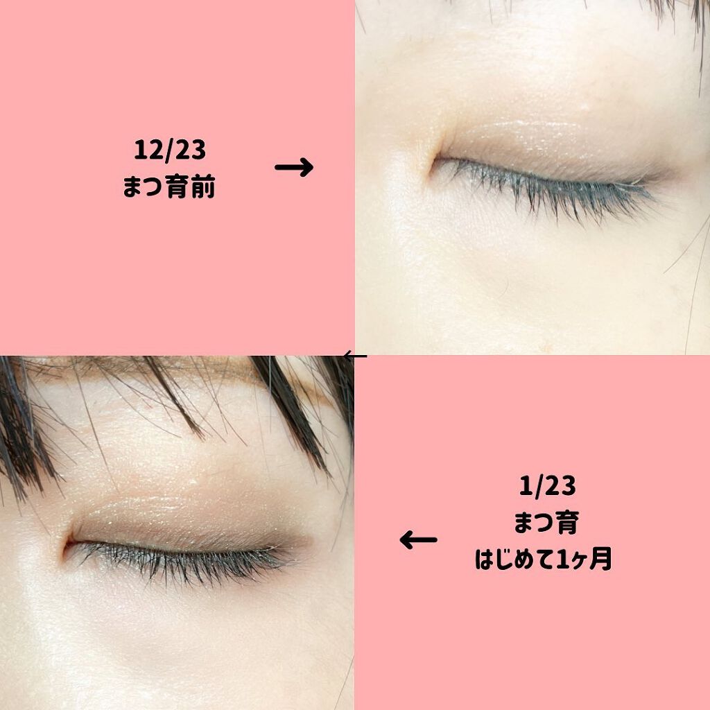 EGUTAM エグータム/アルマダスタイル/まつげ美容液を使ったクチコミ(3枚目)