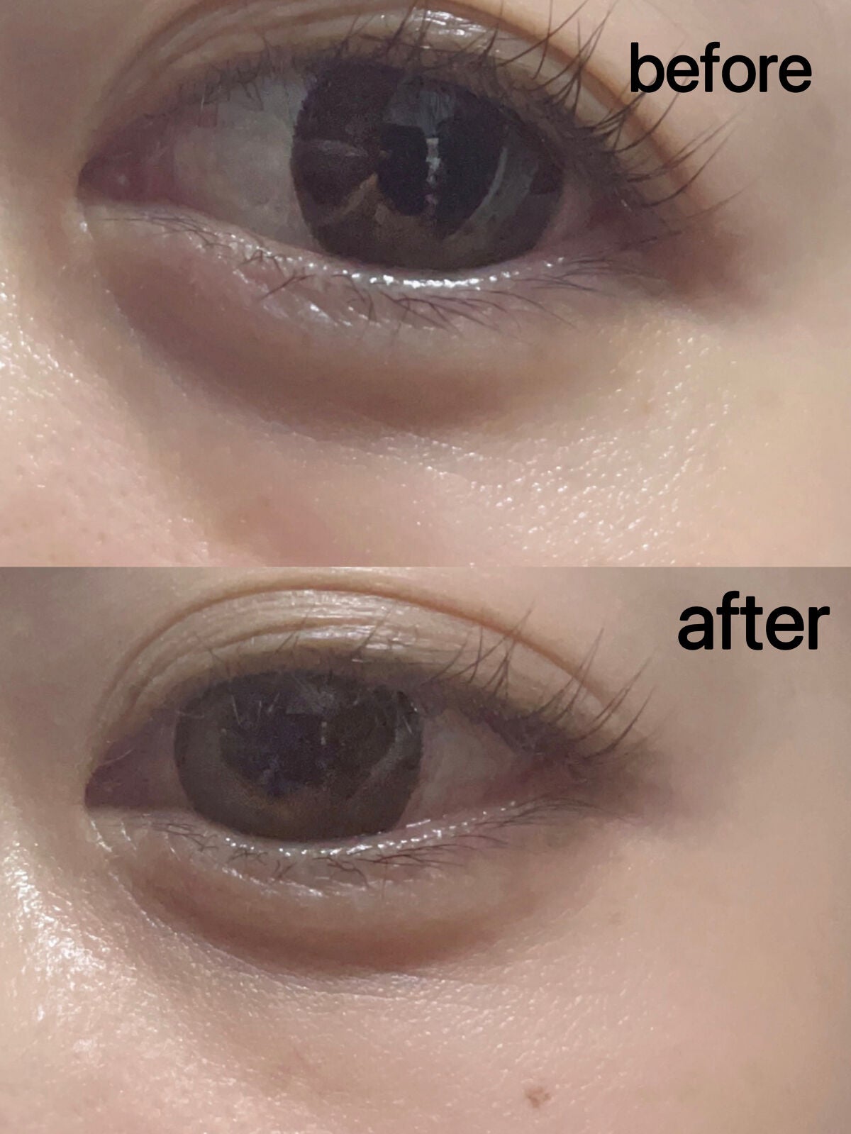 スムースアイコンシーラー/aZTK/クリームコンシーラーを使ったクチコミ(3枚目)