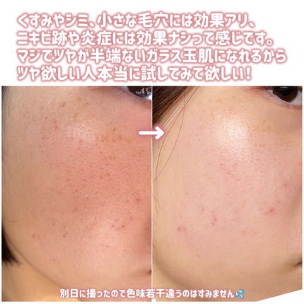 キングスベリービタナイトクリーム/hince/フェイスクリームを使ったクチコミ(4枚目)