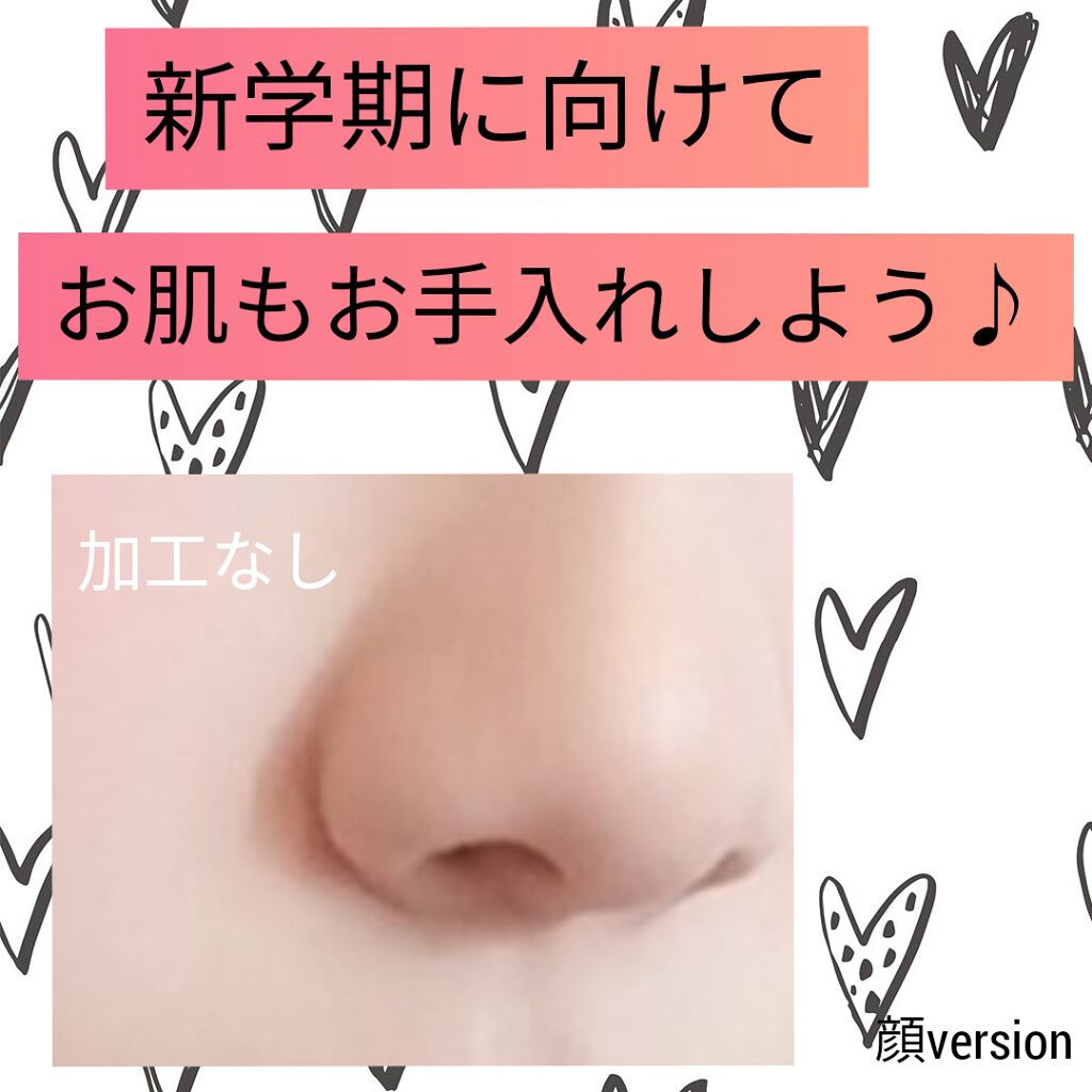 オロナインH軟膏 (医薬品)/オロナイン/その他を使ったクチコミ(1枚目)