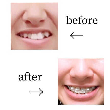 クリニカアドバンテージ ハミガキ/クリニカ/歯磨き粉を使ったクチコミ(2枚目)