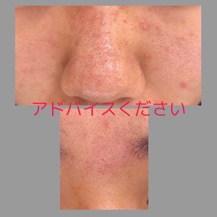 潤浸保湿 化粧水 III とてもしっとり/キュレル/化粧水を使ったクチコミ(3枚目)