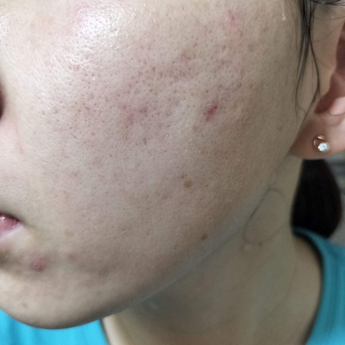 ビオオイル アルガンオイル/Melvita/フェイスオイルを使ったクチコミ(2枚目)