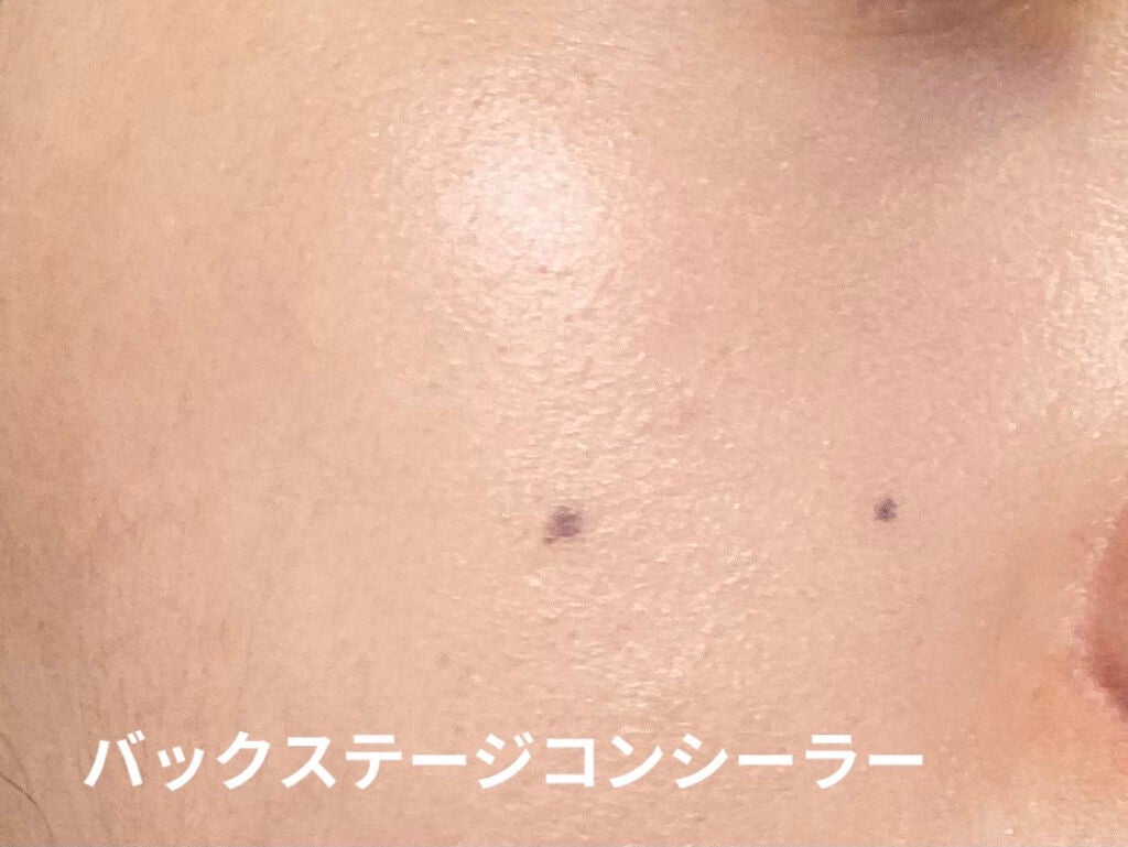 【旧】ディオールスキン フォーエヴァー スキン コレクト コンシーラー/Dior/リキッドコンシーラーを使ったクチコミ(5枚目)