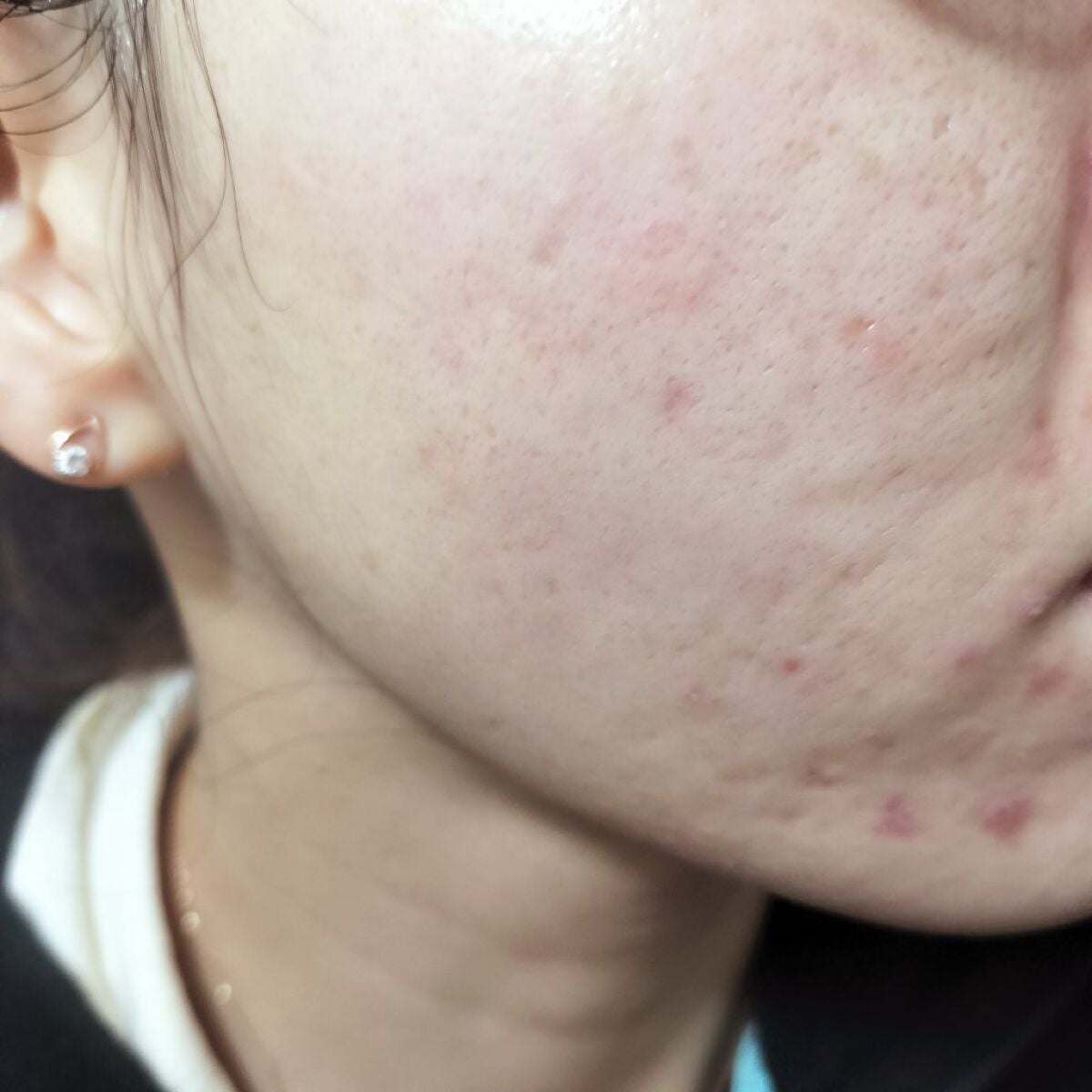 miina@汚肌工事録⚠️ on LIPS 「✍12/4の#汚肌工事録Thanksforyourbrosin..」(1枚目)