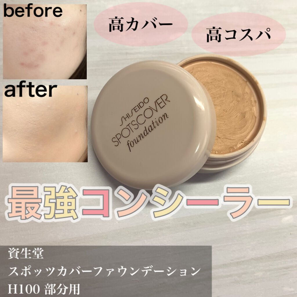 スポッツカバー ファウンデイション/SHISEIDO/クリームコンシーラーを使ったクチコミ（1枚目）