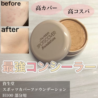 SHISEIDO スポッツカバー ファウンデイションのクチコミ「

 〖もう手放せないかも…カバー力凄すぎる大優勝コンシーラー✨〗


SHISEIDO スポ.....」（1枚目）