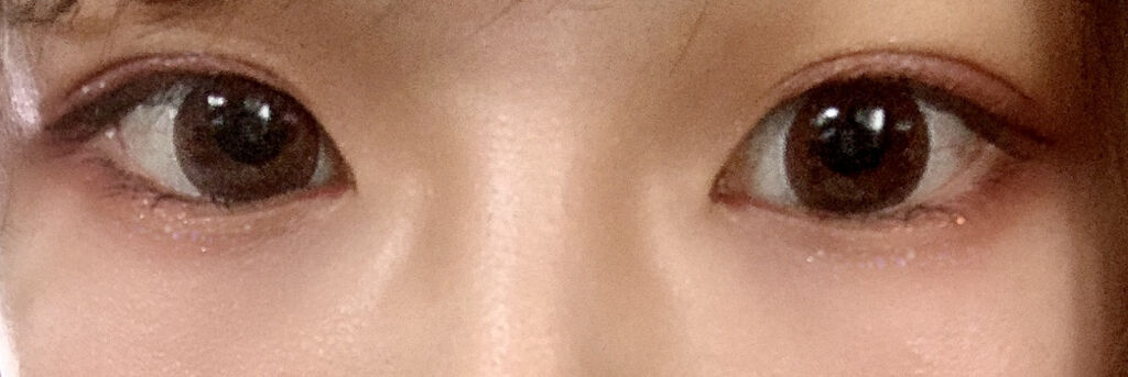 アイビューティー フィクサー WP/アストレア ヴィルゴ/二重まぶた用アイテムを使ったクチコミ（2枚目）