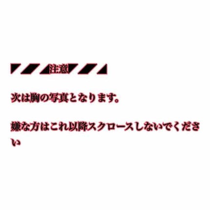 ラシュシュ ナノプラス/La Chou Chou(ラシュシュ)/バスト・ヒップケアを使ったクチコミ(3枚目)