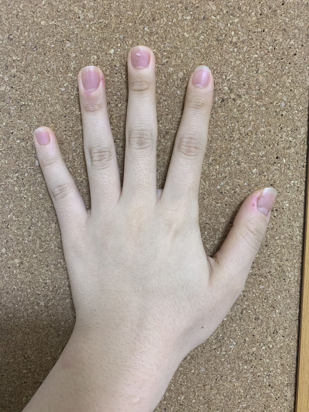 アロマキューティクルオイル/D-UP/ネイルオイル・トリートメントを使ったクチコミ（2枚目）