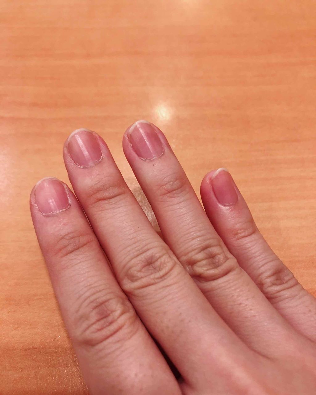 オールインケアコート/ネイリスト/オールインワンネイルを使ったクチコミ（3枚目）