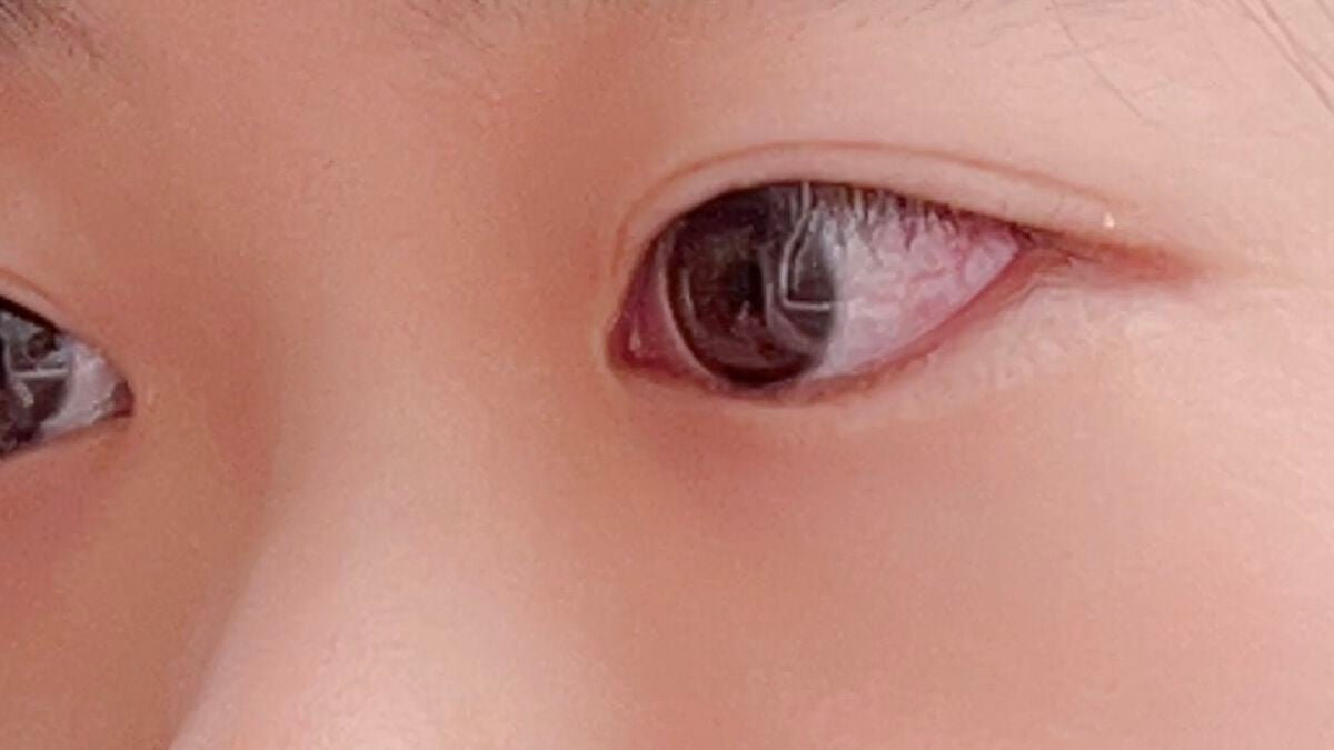 ナイトアイボーテ/StreeTrend/二重まぶた用アイテムを使ったクチコミ(2枚目)