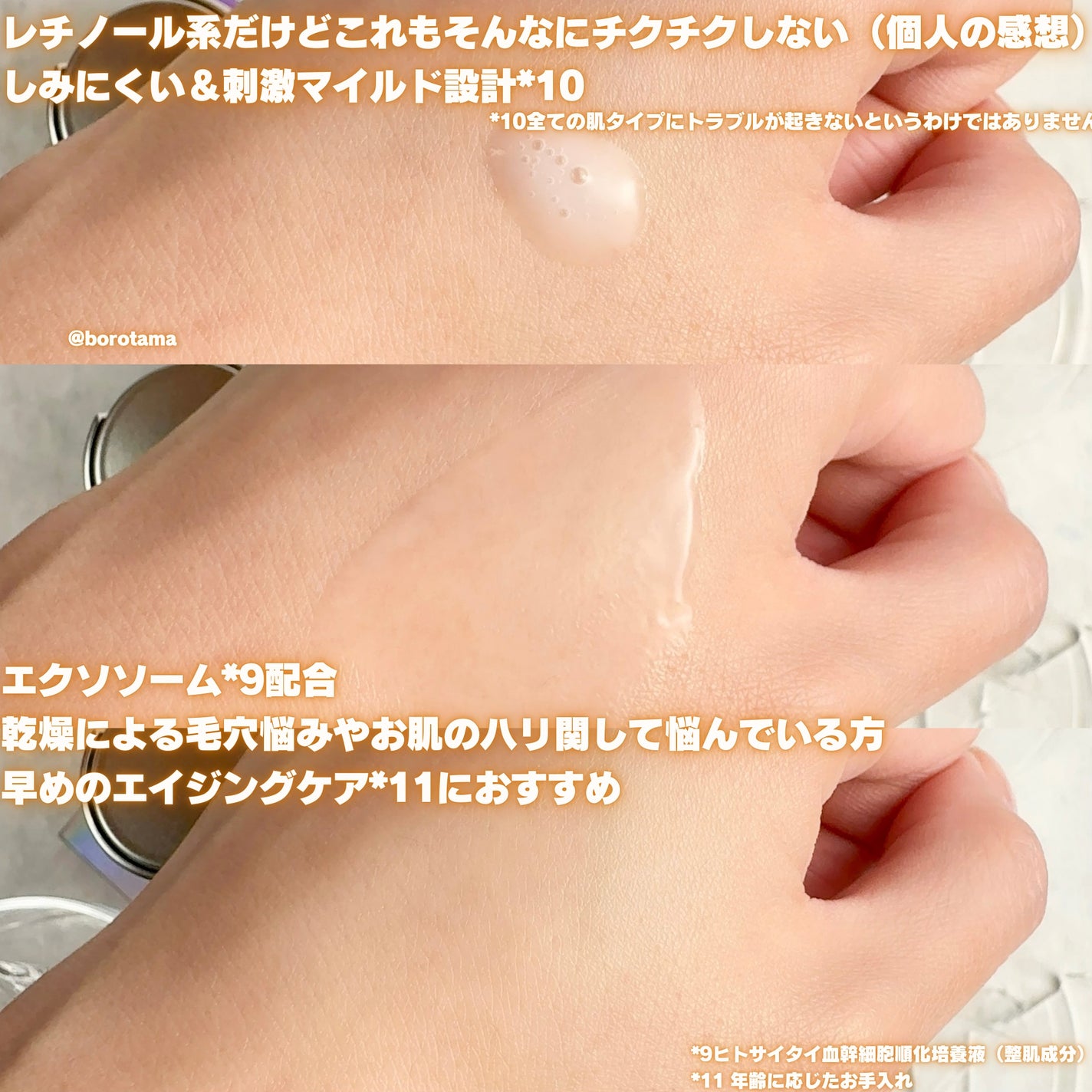 fractionalCC ニードルセラムC/fractionalCC/美容液を使ったクチコミ(6枚目)