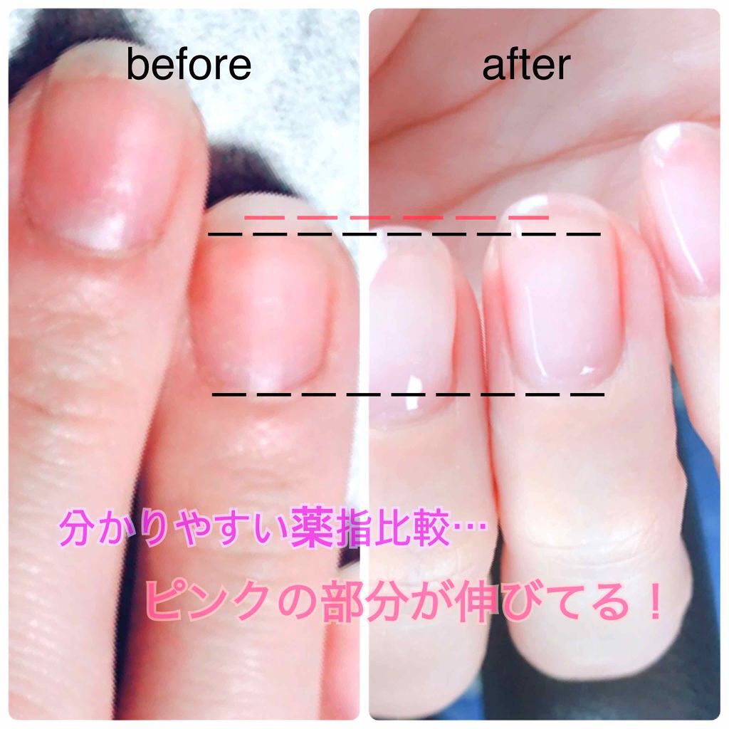 試してみた トリートメントネイルハードナー Jilwors Lips 試してみた トリートメントネイルハードナー Jilwors Lips