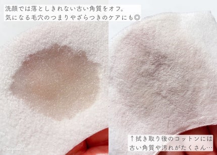 ネイチャーコンク 薬用クリアローション/ネイチャーコンク/拭き取り化粧水を使ったクチコミ(2枚目)