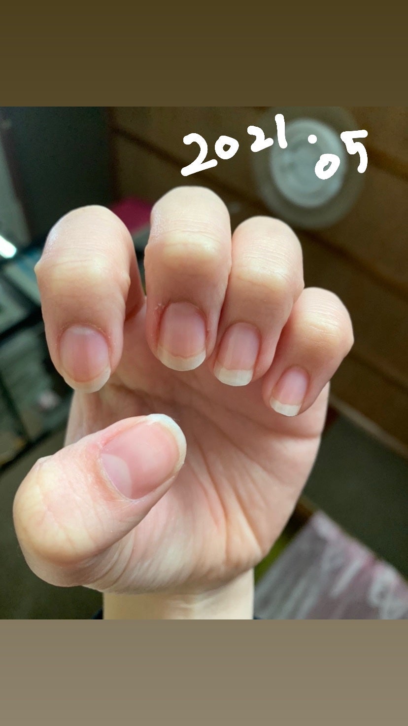 エテュセ クイックケアコート/ettusais/ネイルオイル・トリートメントを使ったクチコミ(5枚目)