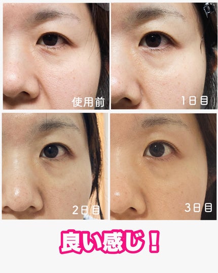 LEUNGESSMORE ブラックPスペシャルフェイスマスク/LEUNGESSMORE/シートマスク・パックを使ったクチコミ(4枚目)